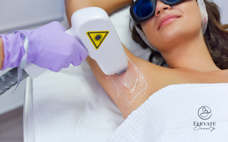 diode-ice-laser-groningen
